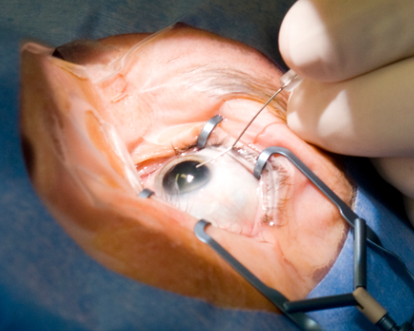  optique optometrists