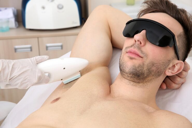 full body laser hair removal